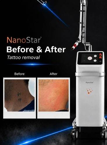 NanoStar®