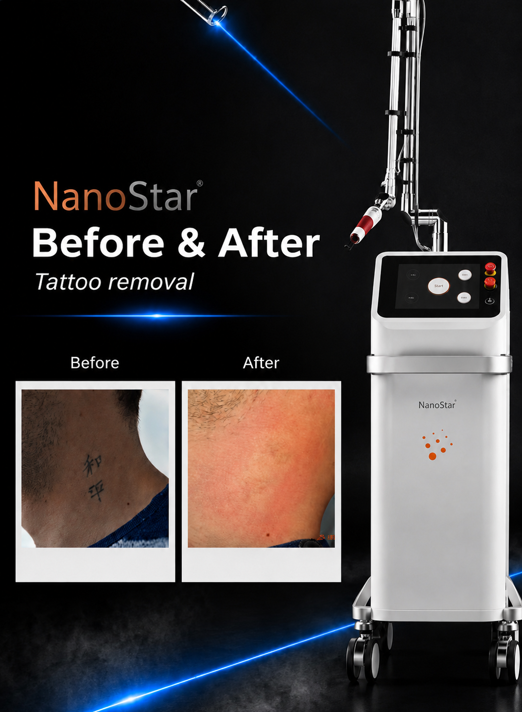 NanoStar®